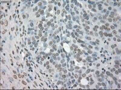 Immunohistochemistry-Paraffin: NEK6 Antibody (OTI5D7) [NBP1-47865]