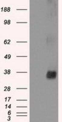 Western Blot: NEK6 Antibody (OTI5D7) [NBP1-47865]