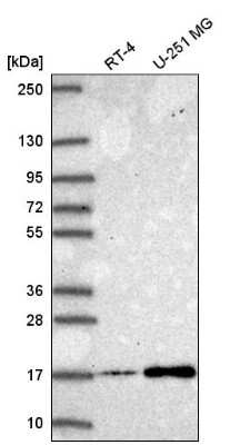 Western Blot: NEK6 Antibody [NBP2-58672]