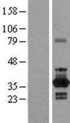 Western Blot: NEK6 Overexpression Lysate [NBL1-13586]