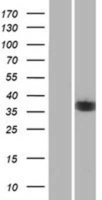 Western Blot: NEK6 Overexpression Lysate [NBP2-09722]