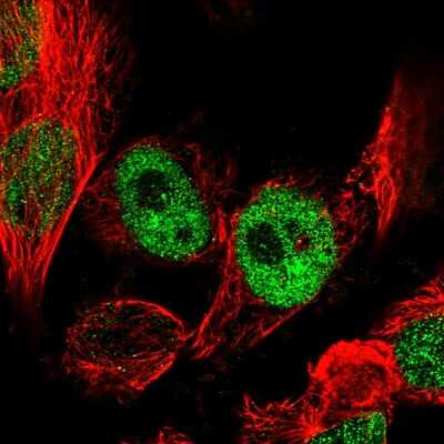 Immunocytochemistry/ Immunofluorescence: NEK7 Antibody [NBP1-86444]