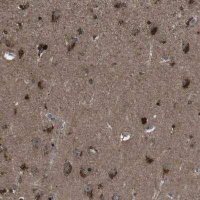 Immunohistochemistry: NEK7 Antibody [NBP1-86457]