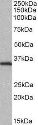 Western Blot: NEK7 Antibody [NBP1-52115]