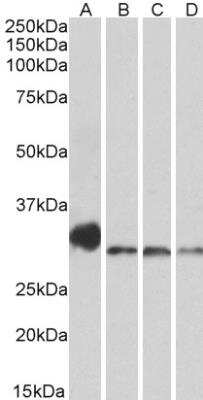 Western Blot: NEK7 Antibody [NBP1-68866]