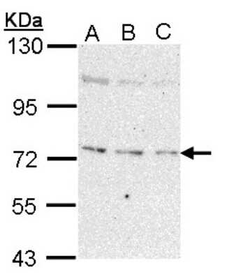 Western Blot: NEK8 Antibody [NBP1-33331]