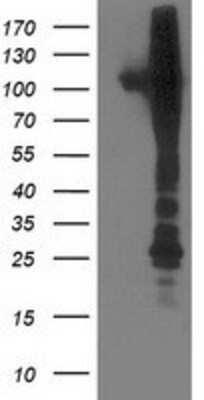 Western Blot: NEK9 Antibody (OTI1H1) [NBP2-01070]