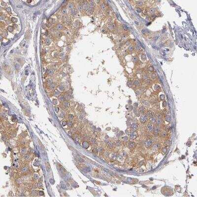 Immunohistochemistry-Paraffin: NEK9 Antibody [NBP1-88007]