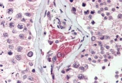 Immunohistochemistry-Paraffin: NEK9 Antibody [NBP3-14416]