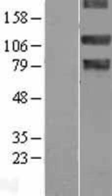 Western Blot: NEK9 Overexpression Lysate [NBL1-13588]