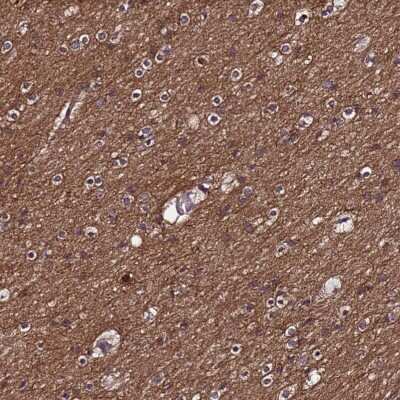 Immunohistochemistry-Paraffin: NELF Antibody [NBP1-92175]