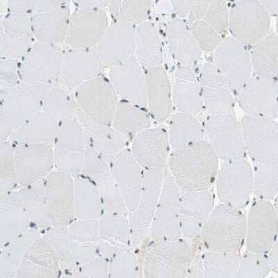 Immunohistochemistry-Paraffin: NELF-E Antibody [NBP1-88036]