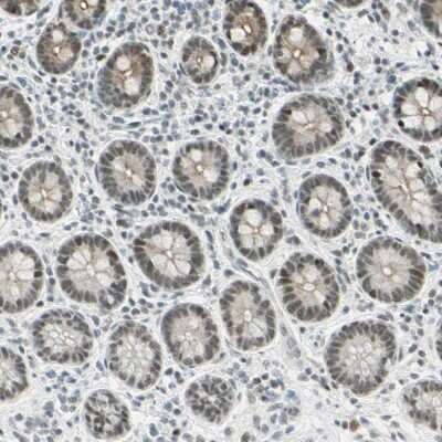 Immunohistochemistry-Paraffin: NELF-E Antibody [NBP1-88036]