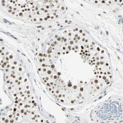 Immunohistochemistry-Paraffin: NELF-E Antibody [NBP1-88036]