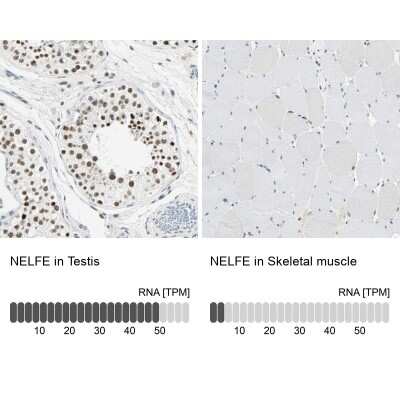 Immunohistochemistry-Paraffin: NELF-E Antibody [NBP1-88036]