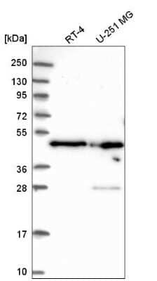 Western Blot: NELF-E Antibody [NBP2-55487]