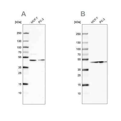 Western Blot: NELF-E Antibody [NBP2-55487]