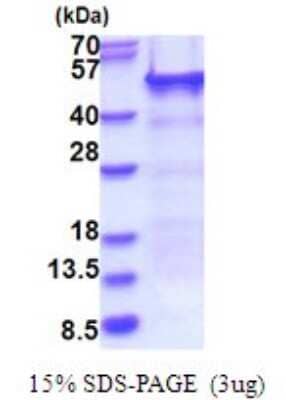 SDS-PAGE: Recombinant Human NELF-E His Protein [NBP2-51698]