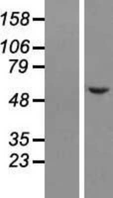 Western Blot: NELF Overexpression Lysate [NBL1-13589]