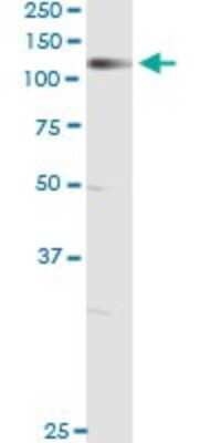Immunoprecipitation: NELL1 Antibody (6A8) [H00004745-M01]