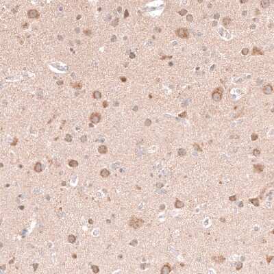 Immunohistochemistry-Paraffin: NELL1 Antibody [NBP2-13651]