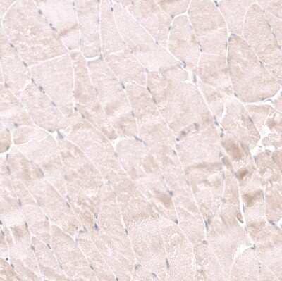 Immunohistochemistry-Paraffin: NELL1 Antibody [NBP2-13651]