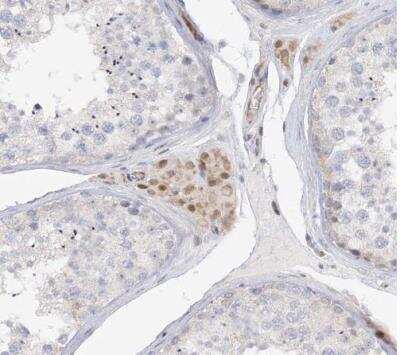 Immunohistochemistry-Paraffin: NELL2 Antibody [NBP1-82527]