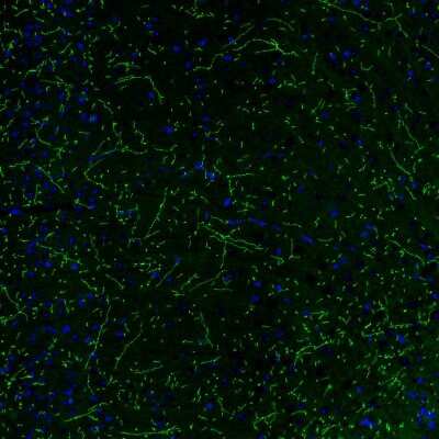 Immunohistochemistry: NET1 Antibody (CL3063) [NBP2-46648]