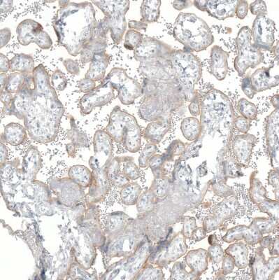 Immunohistochemistry-Paraffin: NET1 Antibody (CL3063) [NBP2-46648]