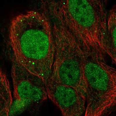 Immunocytochemistry/ Immunofluorescence: NET1 Antibody [NBP2-13653]