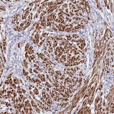 Immunohistochemistry-Paraffin: NET1 Antibody [NBP2-13653]
