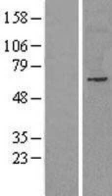 Western Blot: NET1 Overexpression Lysate [NBL1-13592]