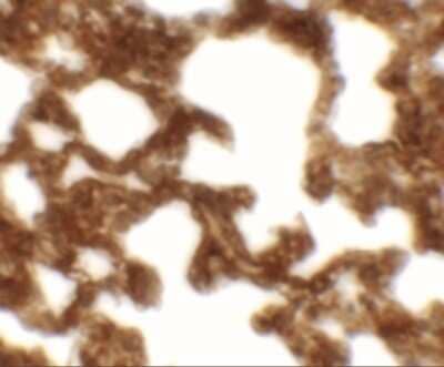 Immunohistochemistry-Paraffin: NETO1 Antibody - BSA Free [NBP2-41134]