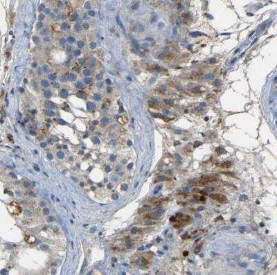 Immunohistochemistry-Paraffin: NETO2 Antibody [NBP1-84624]