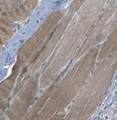 Immunohistochemistry-Paraffin: NETO2 Antibody [NBP1-84624]