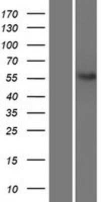 Western Blot: NETO2 Overexpression Lysate [NBL1-13593]