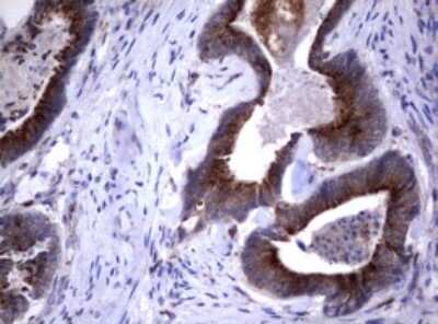 Immunohistochemistry: NEU-1/Sialidase-1 Antibody (OTI3D4) [NBP2-46152]