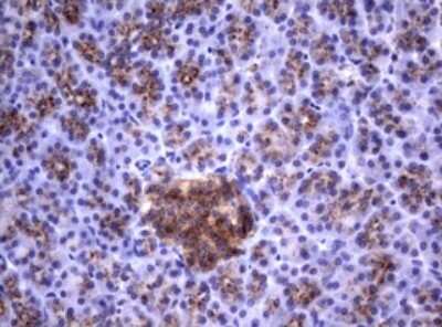 Immunohistochemistry: NEU-1/Sialidase-1 Antibody (OTI3D4) [NBP2-46152]