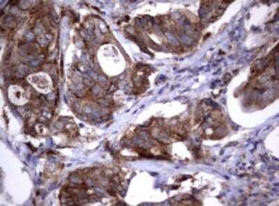 Immunohistochemistry: NEU-1/Sialidase-1 Antibody (OTI3D4) [NBP2-46152]
