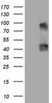 Western Blot: NEU-1/Sialidase-1 Antibody (OTI3D4) [NBP2-46152]