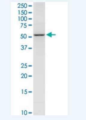 Western Blot: NEU-1/Sialidase-1 Antibody (3F9) [H00004758-M01-100ug]