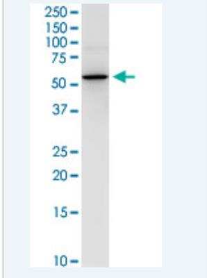 Western Blot: NEU-1/Sialidase-1 Antibody (3F9) [H00004758-M01-100ug]