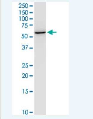 Western Blot: NEU-1/Sialidase-1 Antibody (3F9) [H00004758-M01-100ug]