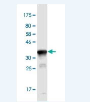 Western Blot: NEU-1/Sialidase-1 Antibody (3F9) [H00004758-M01-100ug]