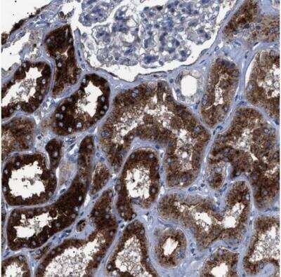 Immunohistochemistry-Paraffin: NEU-1/Sialidase-1 Antibody [NBP1-87755]
