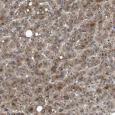 Immunohistochemistry-Paraffin: NEU-1/Sialidase-1 Antibody [NBP1-87756]