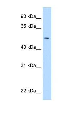 Western Blot: NEU-1/Sialidase-1 Antibody [NBP1-69387]