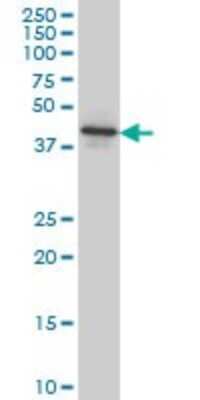 Western Blot: NEU2 Antibody (3B9) [H00004759-M03]