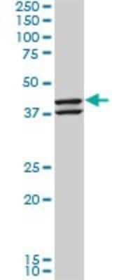 Western Blot: NEU2 Antibody (3B9) [H00004759-M03]