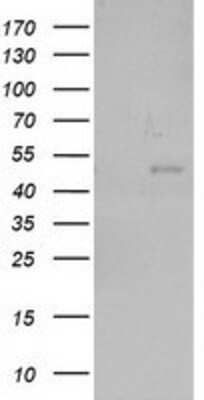 Western Blot: NEU2 Antibody (OTI4F4) [NBP2-00783]